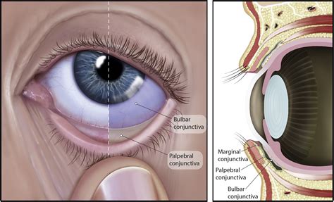 CLEAR - Anatomy and physiology of the anterior eye - Contact Lens and ...