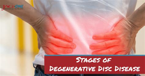 Stages of Degenerative Disc Disease | Physical Therapy | JAG-ONE in NJ, NY and PA