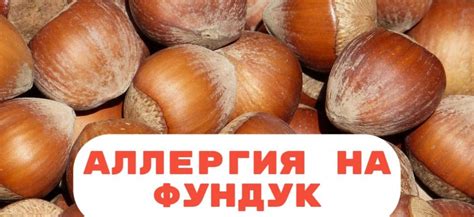 Аллергия на фундук может ли быть, симптомы и лечение