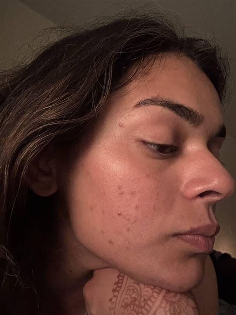 Exfoliating Face Mask | Skin Care Masks | Radiant Skin