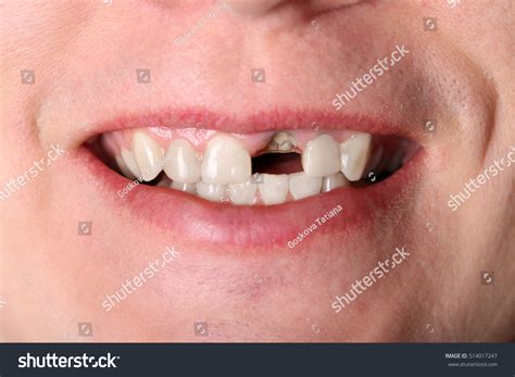 man  teeth images stock  vectors shutterstock