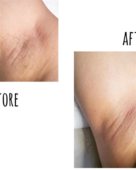 Lumen Spa | Claremont CA