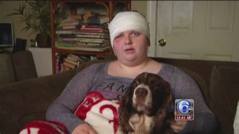 Teen speaks out after bear attack in Florida - 6abc Philadelphia