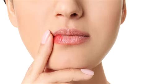 Why do i have a bump on my lip: causes and how to react