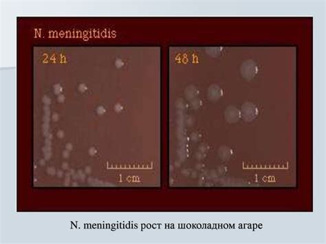 Менингококк. Эпидемическая обстановка по менингококковой инфекции ...
