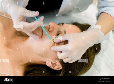 aesthetic procedure involving hyaluronic acid  botox injections