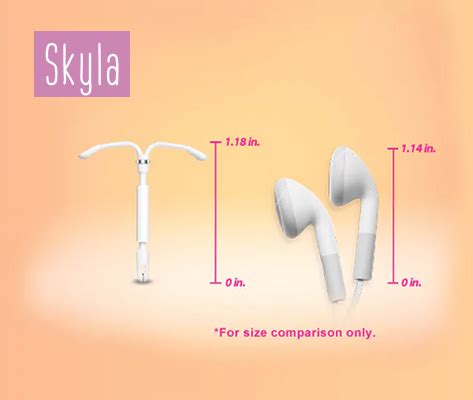 Types of IUDs | CU PAG