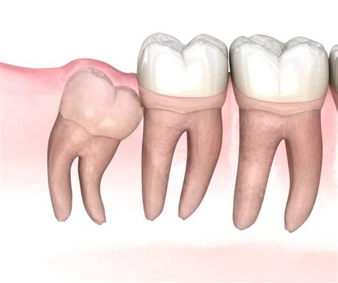 dental anatomy  maxillary molar tooth medically accurate dental