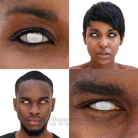 Blind Sclera Contacts