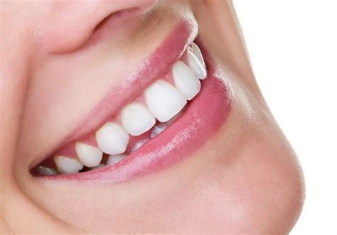 Can You Fully Remineralize Teeth? (Ultimate Guide)
