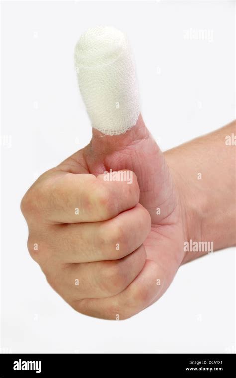 Thumb Injuries High Resolution Stock Photography and Images - Alamy