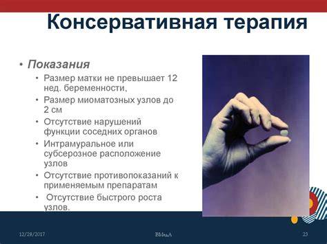Субмукозная миома матки - презентация онлайн