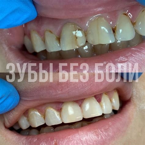 Стоматология ЗУБЫ БЕЗ БОЛИ | Ульяновск | ВКонтакте