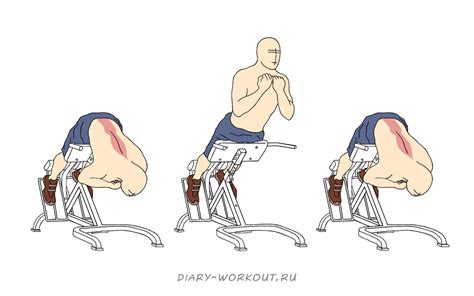 Гиперэкстензия