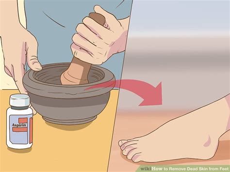 3 Ways to Remove Dead Skin from Feet - wikiHow