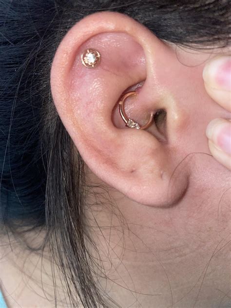 The Bump Blues: 5 Natural Remedies To Soothe Your Piercing Woes