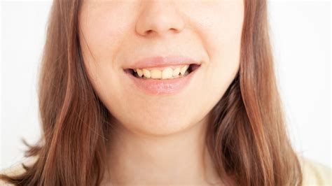Biofilme dental: características, estágios e como tratar