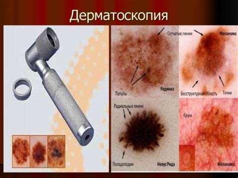 Дерматоскопия по доступной цене | Диагностика меланомы в Санкт-Петербурге