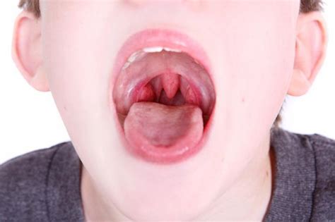 What Makes Kids More Susceptible to Strep Throat?: Express Lane Urgent Care: Urgent Care