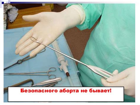 Аборт и его осложнения - презентация онлайн