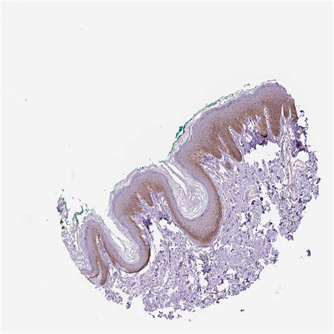 Tissue expression of EGFR - Staining in skin - The Human Protein Atlas