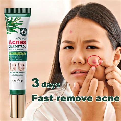 tea tree acne oil control face gel anti acne gel pimple cream acne