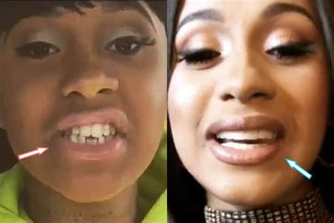 Cardi B Plastic Surgery REVEALED! (Before & After Photos 2021)