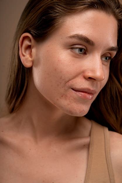 Premium Photo | Portrait of person with dermatitis skin condition