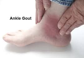 ankle heel pain treatment specialists dpmc