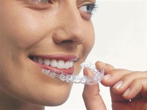 invisible braces basic knowledge invisible braces