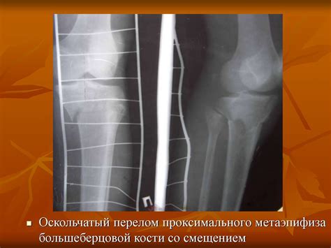 Повреждения голени, голеностопного сустава и стопы - презентация онлайн