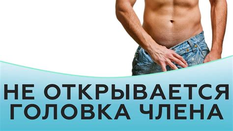 Не открывается головка члена - YouTube