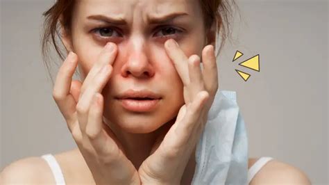 iritasi kulit wajah gejala penyebab   mengatasinya orami