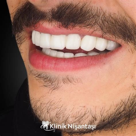 Klinik Nişantaşı - #Periodontoloji Diş hijyeni…