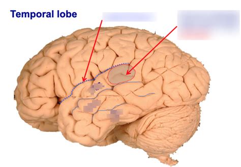 Temporal lobe - parts and function Diagram | Quizlet