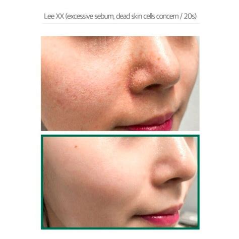 Some By Mi AHA BHA PHA 30 Days Miracle Truecica Clear Pad – Nudie Glow