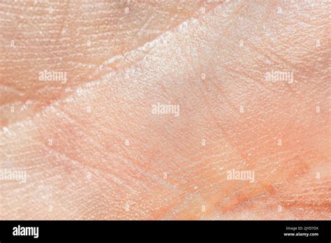 The texture of the skin of a human hand Stock Photo - Alamy