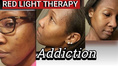 Red Light Face Therapy