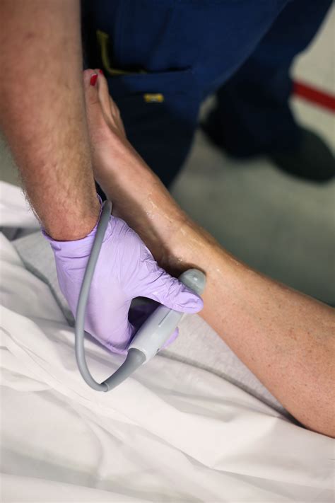 Atlas Of Ultrasound And Nerve Stimulation Guided Regional Anesthesia 10