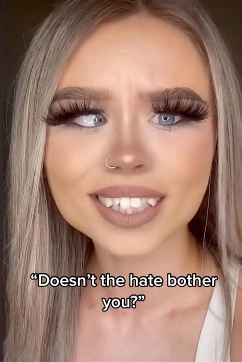 Elley Davies defies bullies who poke fun at 'lazy' eye - Daily Star