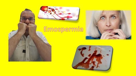Il sangue nel liquido seminale. Emospermia. Cosa fare ? E' pericoloso ...