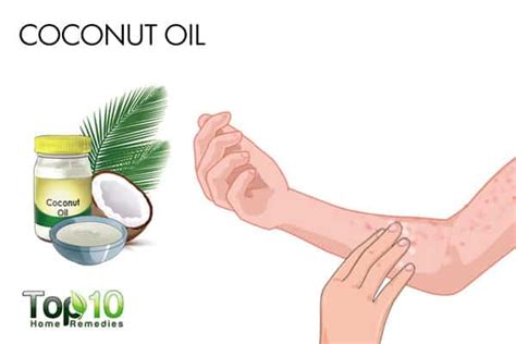 How to Get Rid of Bumps on Arms | Top 10 Home Remedies