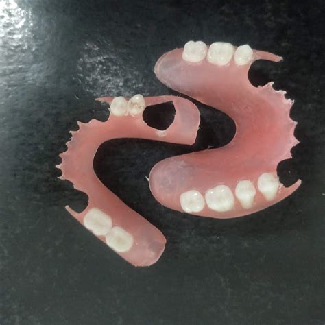 custom pink valplast partial denture affordable flexible buy