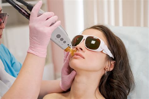 Depilacao A Laser Rosto - Depilação a laser no rosto: profissional fala sobre benefícios e riscos