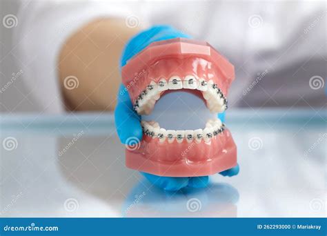 doctor orthodontist showing model  human jaw  wire braces