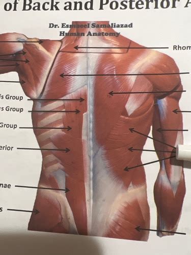 Muscle (practical) Posterior Thoracic muscles Flashcards | Quizlet