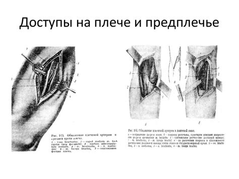 Топографическая анатомия и оперативная хирургия верхних конечностей ...