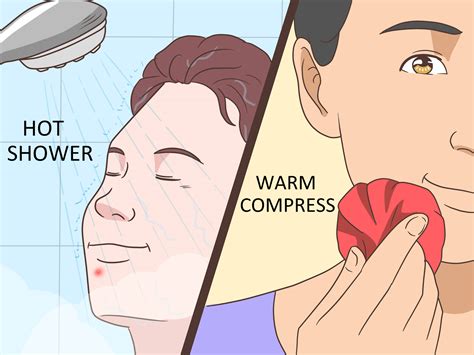 how to make pimples go away fast 10