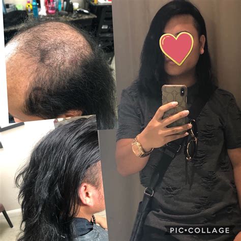 Before & After – Temecula Wigs