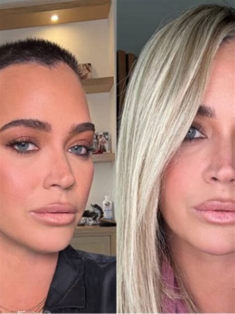 Teddi Mellencamp Undergoes Treatment for Advanced Melanoma - Karmactive